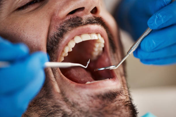 Best Pediatric Emergency Dentist in Casselberry, FL